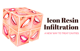 Icon Resin Infiltration: A New Way to Treat Cavities