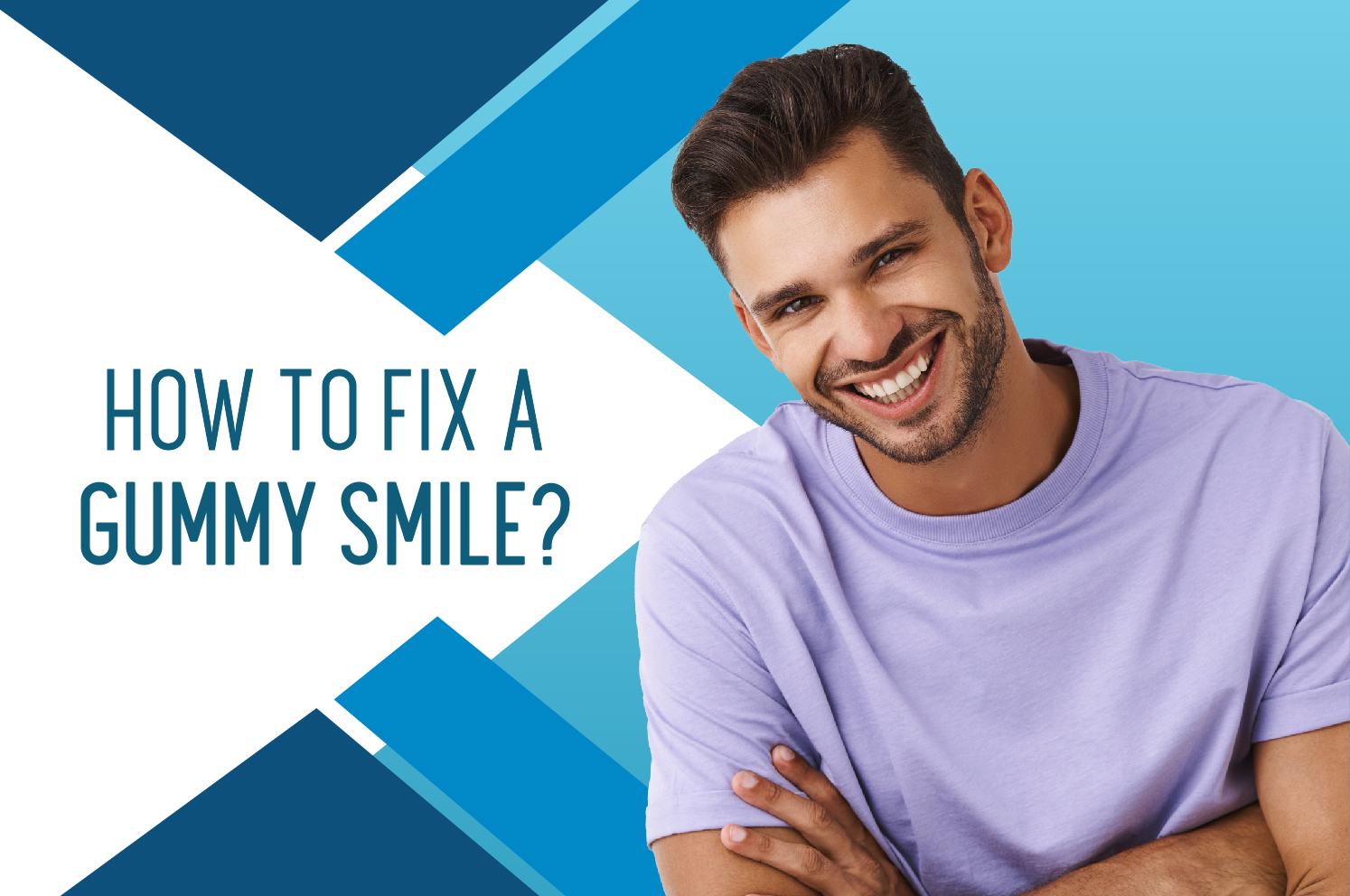 How to fix a gummy smile?