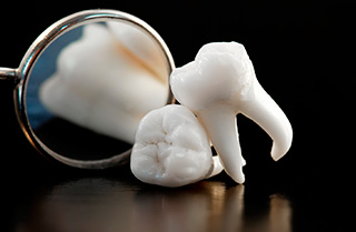 Lost a Tooth? Your Pasadena Dentist Gives You Options!