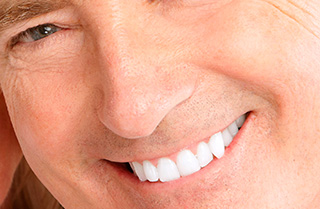 do sensitive teeth after teeth whitening