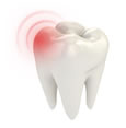 Root Canal Therapy Pasadena