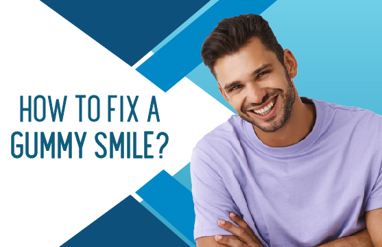 How to fix a gummy smile?