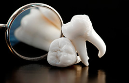 Wisdom Teeth: In or Out? Pasadena Dentist Explains the Pros and Cons of Extraction