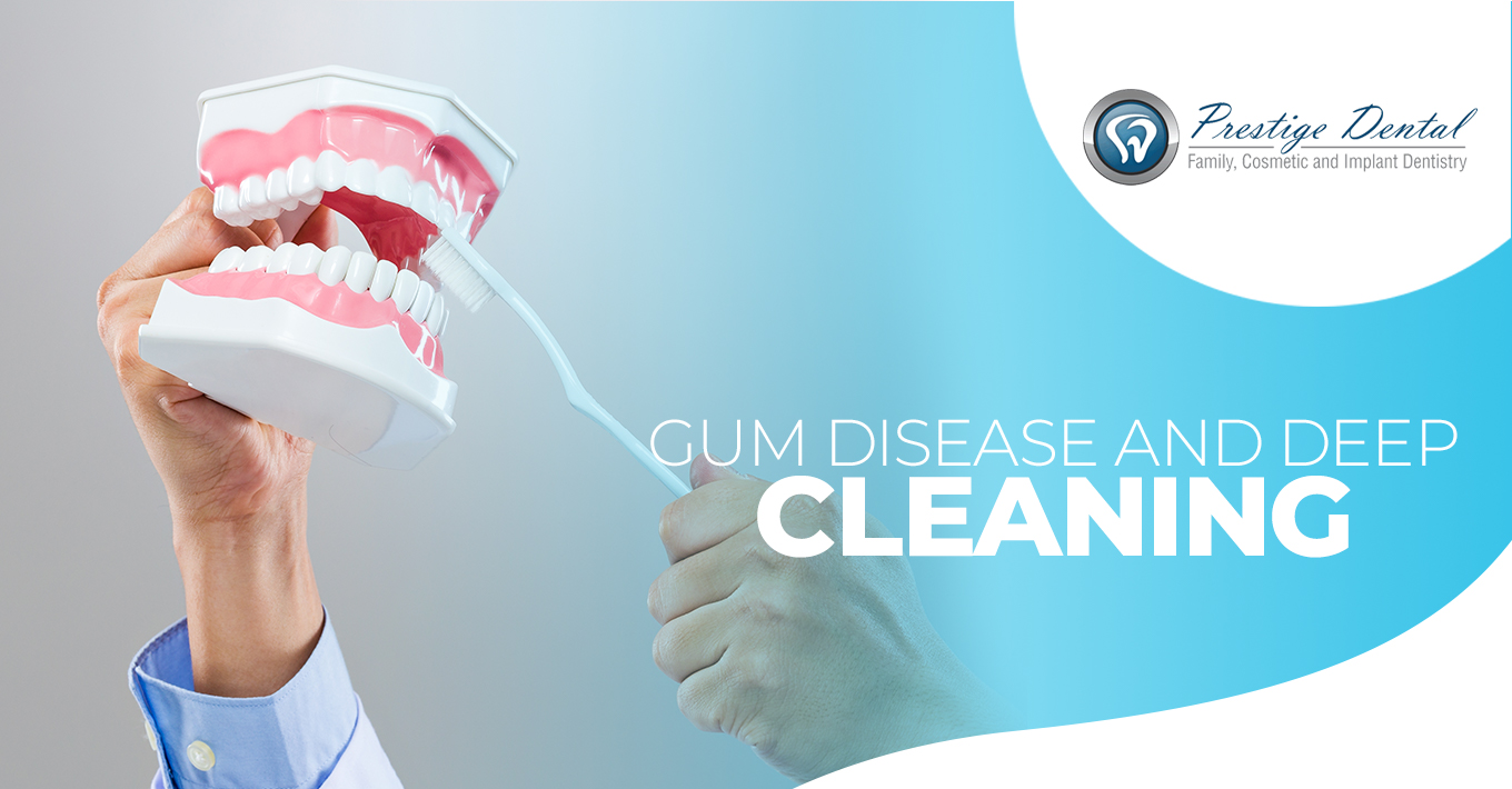 Dental Articles Pasadena Dentist Dentistry News