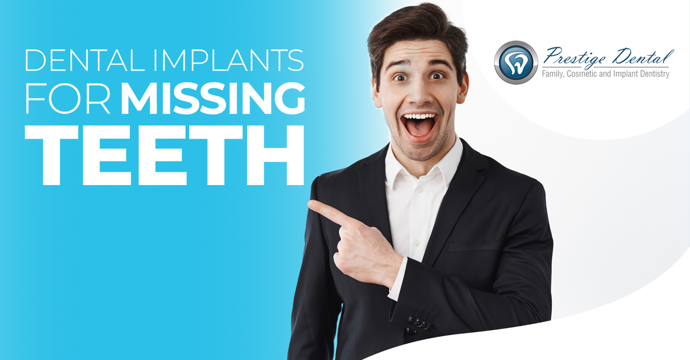 Pasadena Dental Implants Implants for Missing Teeth Pasadena