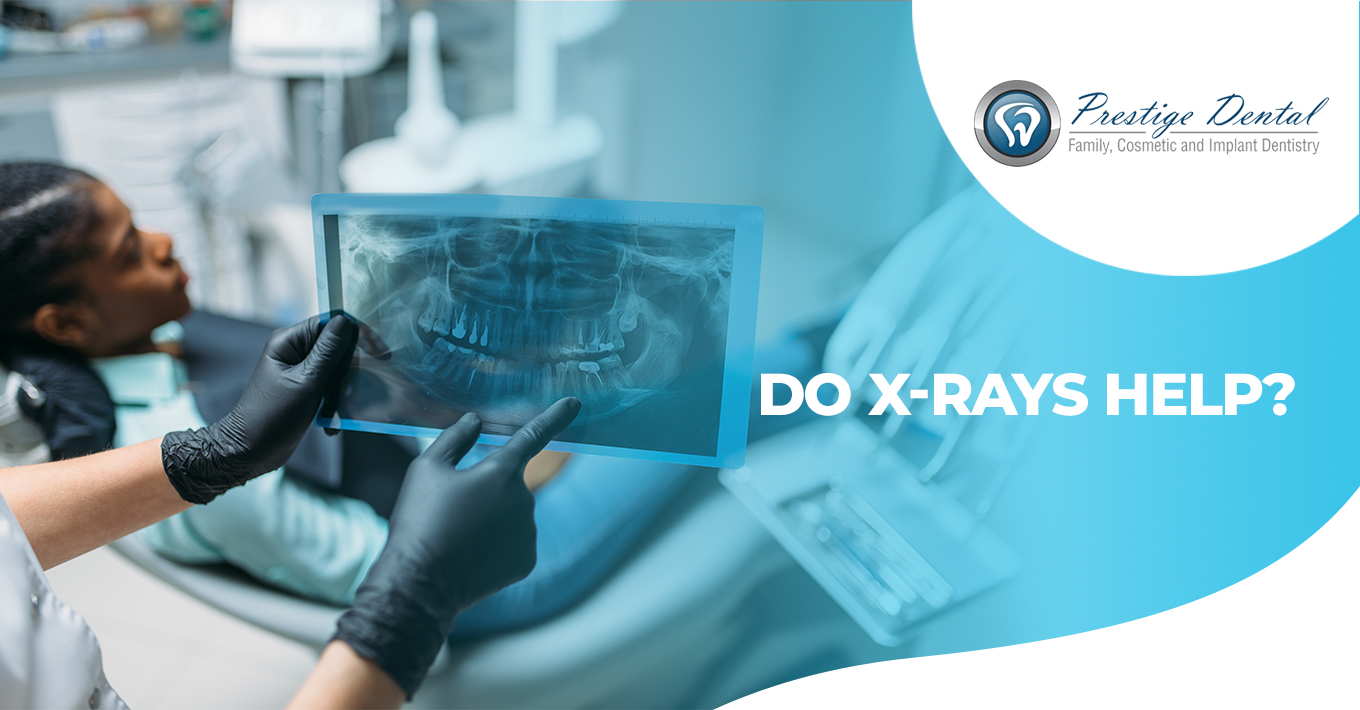 Dental Technology Digital XRays, Oral Cancer Detection Pasadena
