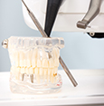 Dental implant model with teeth and dentist tools on a clinic table